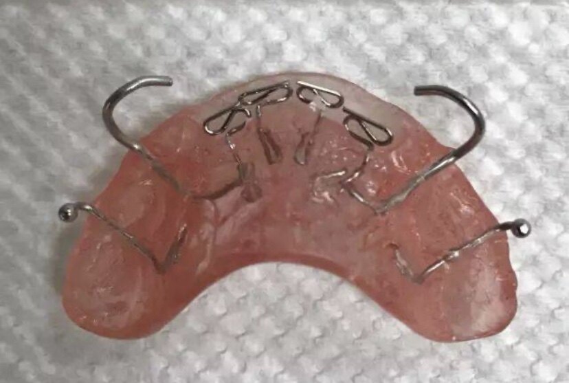 双曲舌簧颌垫矫治器图片