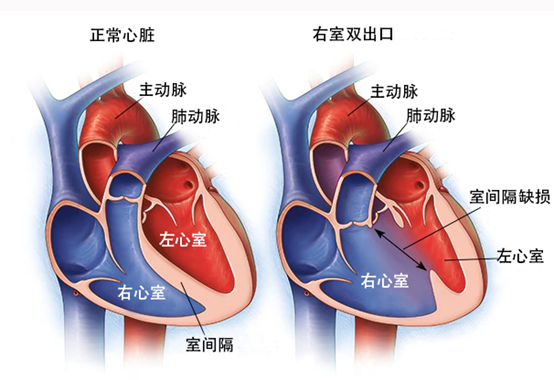 右心室内部结构解剖图图片