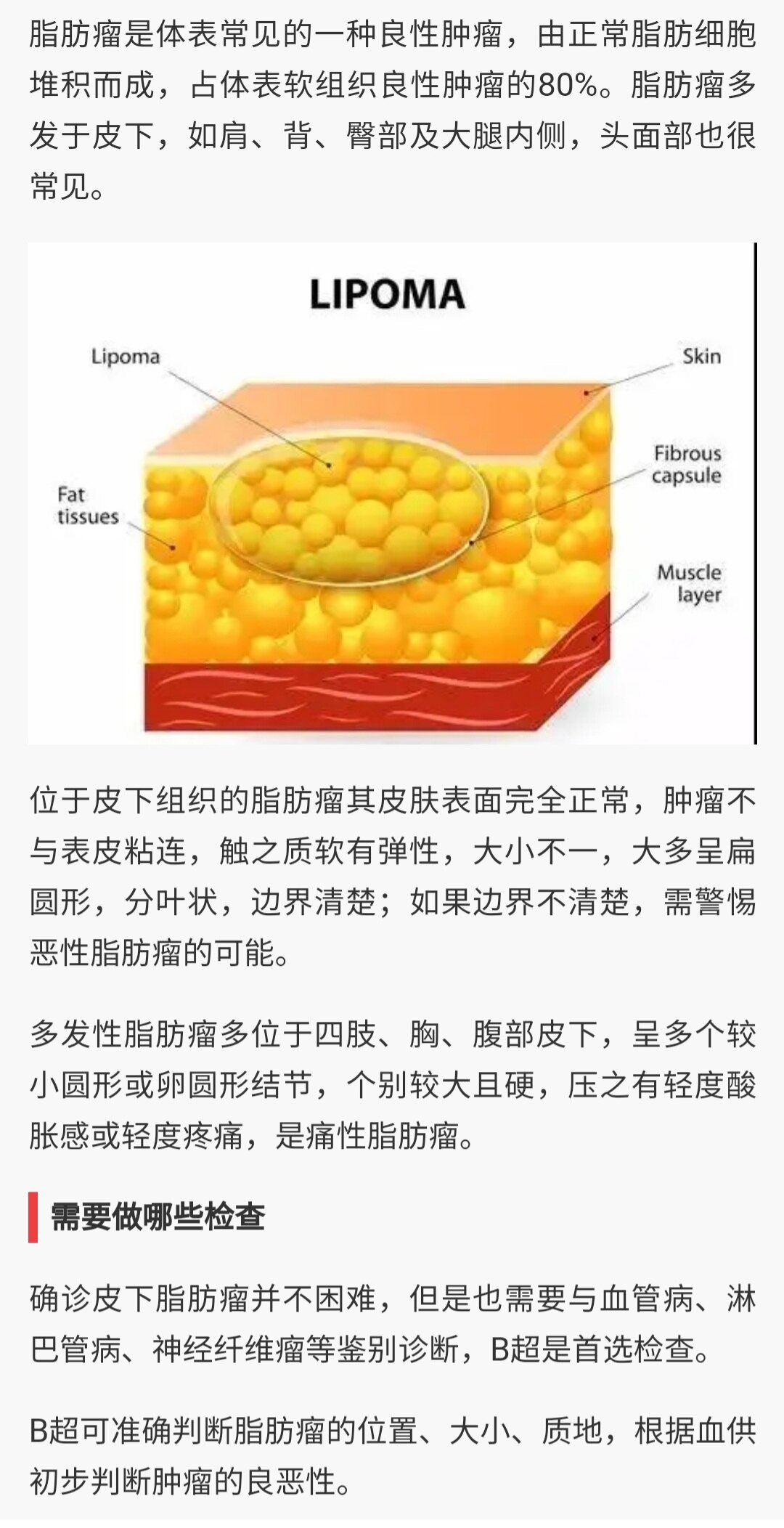 什么是脂肪瘤