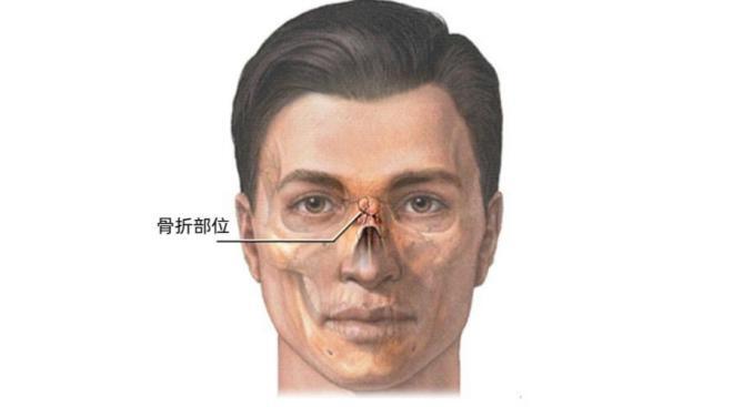 圖文圖片