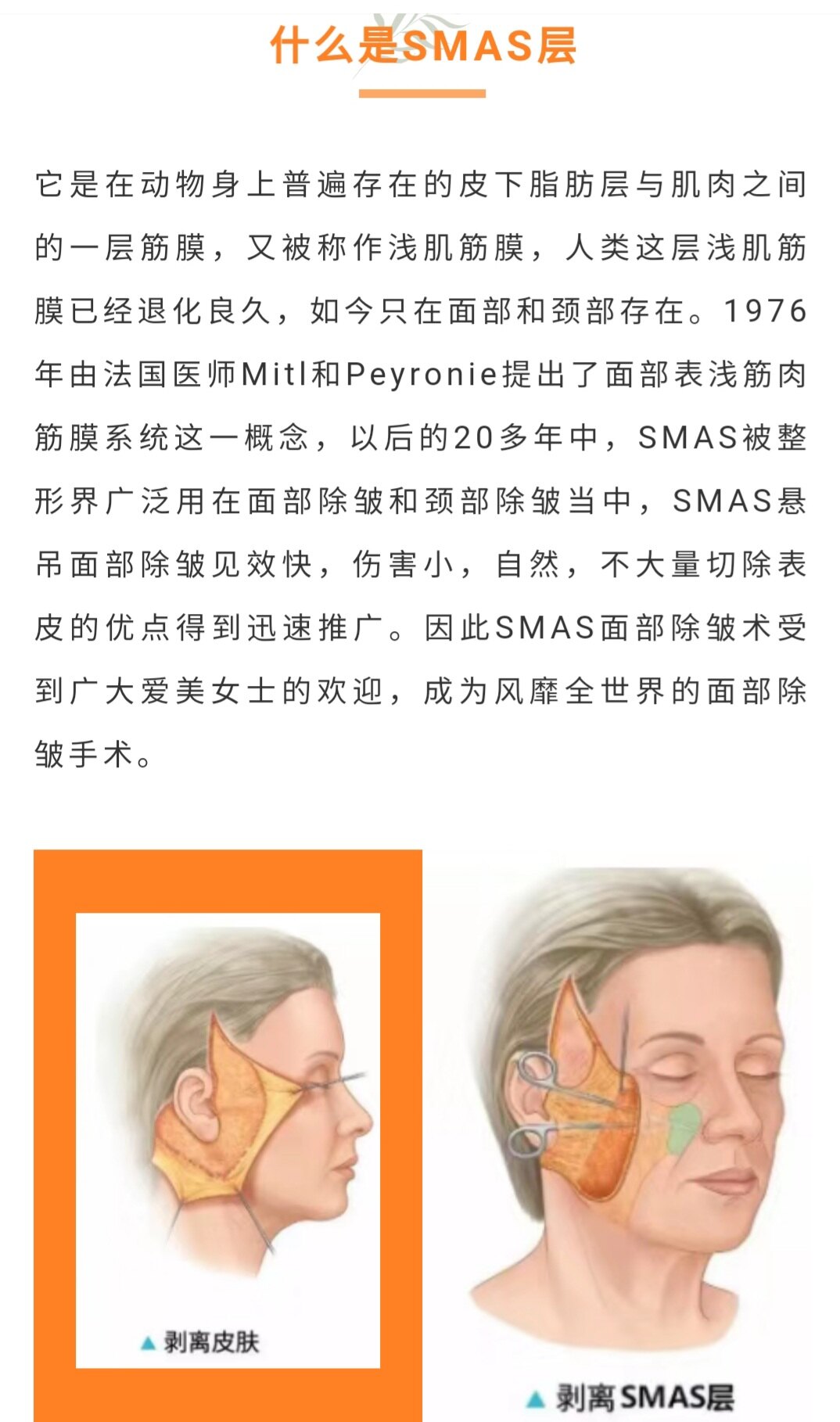 什么是面部提升术中的smas层?_手术除皱 - 好大夫在线