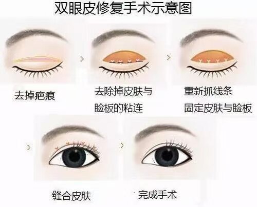 圖文圖片