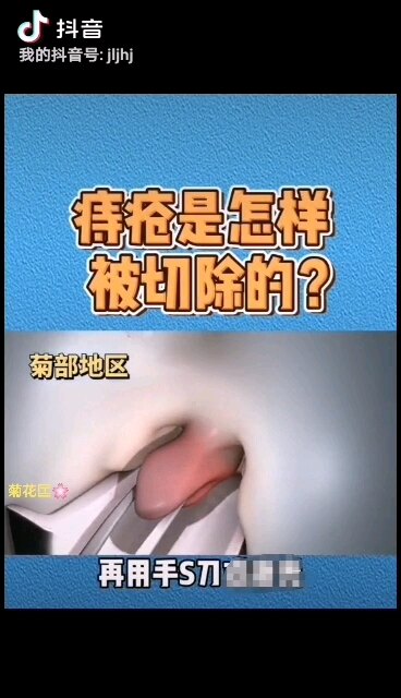 默认图片