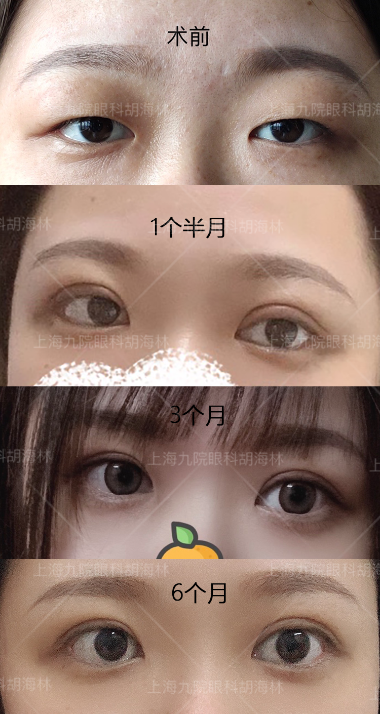 对比.png