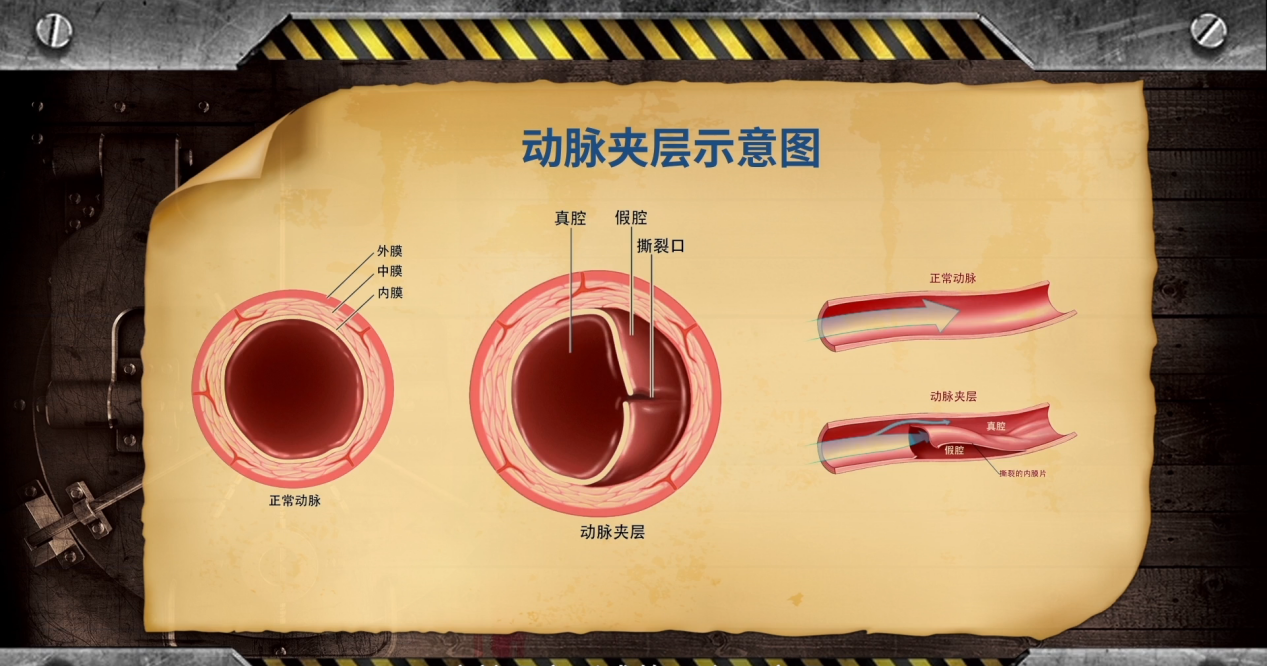 被动吸烟比主动吸烟危害更大吗_冠状动脉夹层破裂视频_被动吸烟和主动吸烟