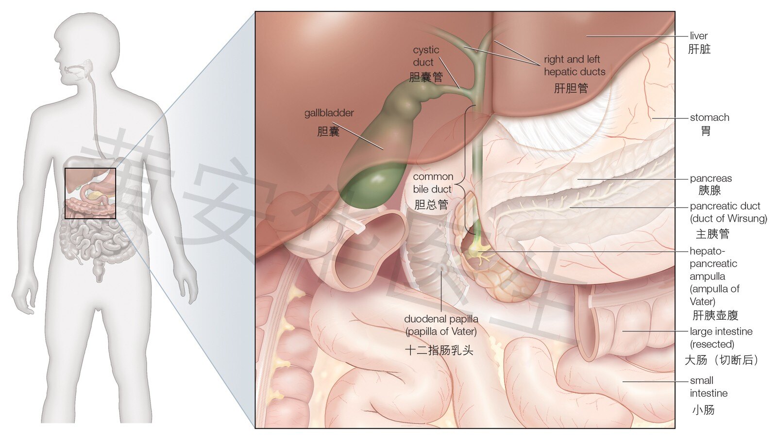 cholangiopancreatoscopy-bile-duct-ducts-endoscope-tumours-gallstones_副本.jpg