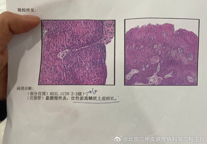 圖文圖片