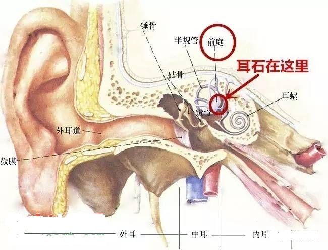 耳石症挂哪个科图片