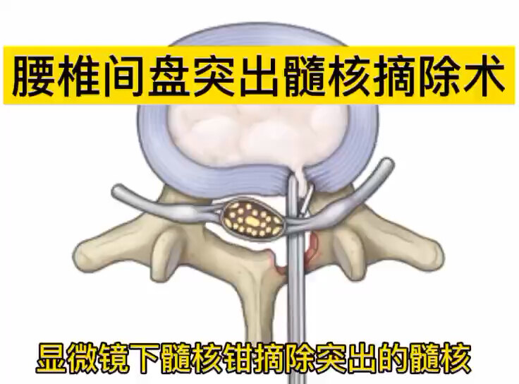 默认图片