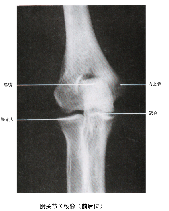 尺桡骨x线解剖图片
