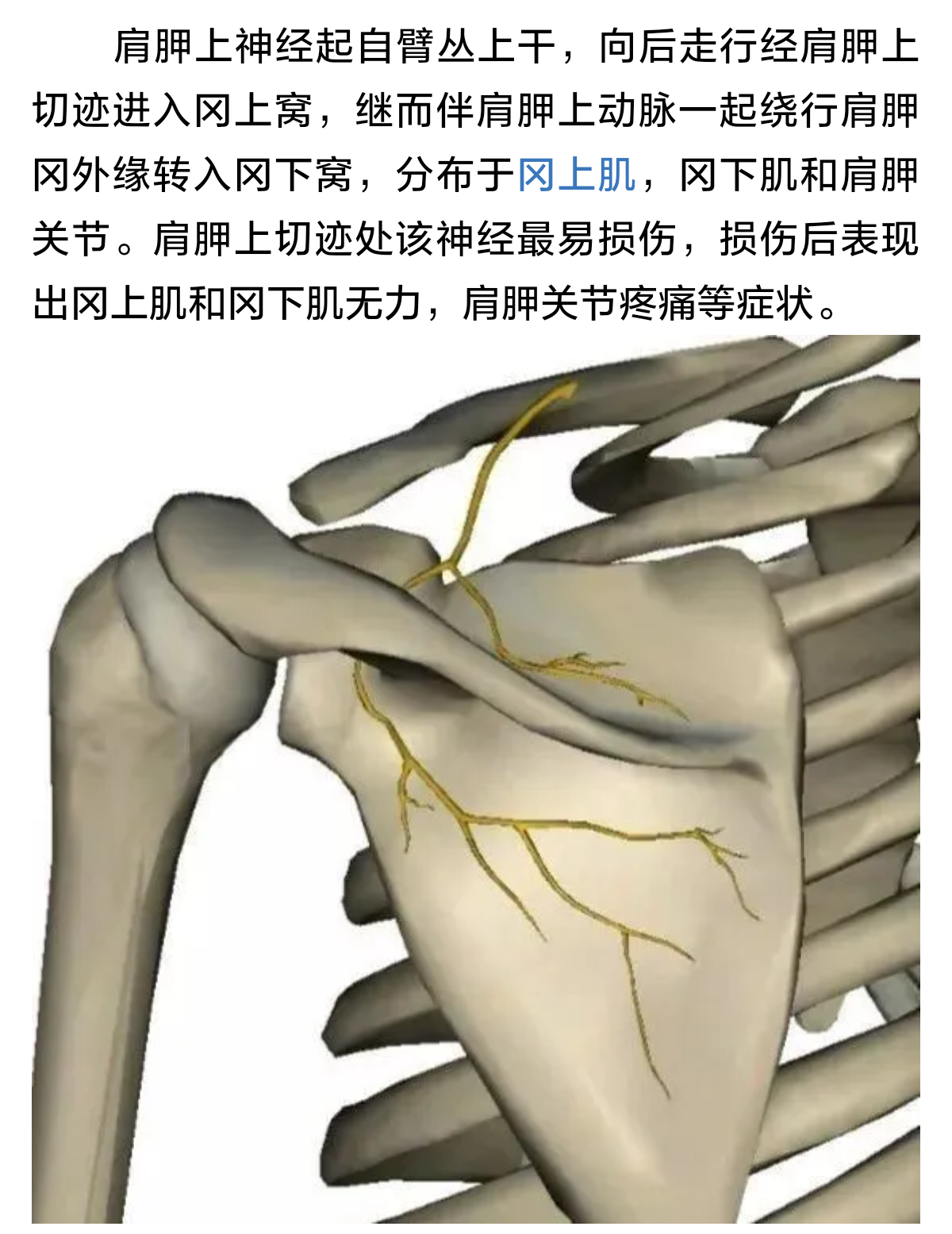 肩痛:肩胛上神经卡压综合征～一种容易忽视的肩痛原因(专业版)