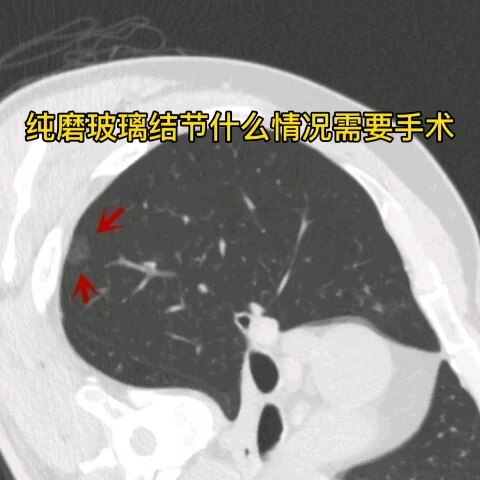 默认图片