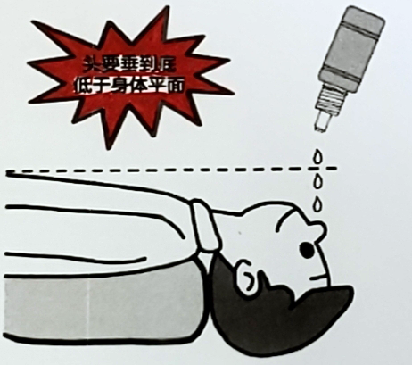 小儿鼾症中滴鼻液的正确使用方法_鼻疾病_用药_相关疾病 - 好大夫在线