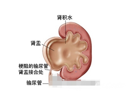 1609165453603195.png 图片2.png