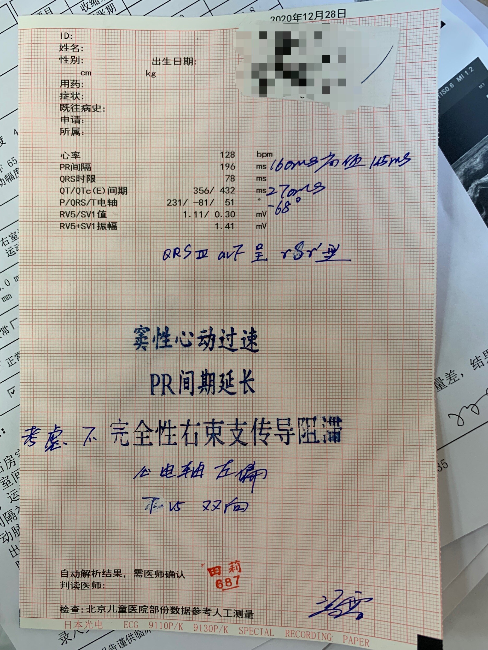 先天性心脏病术后 窦性心律 小儿心律失常 小儿心律失常 先天性心脏病术后 窦性心律 小儿心律失常 小儿心律失常