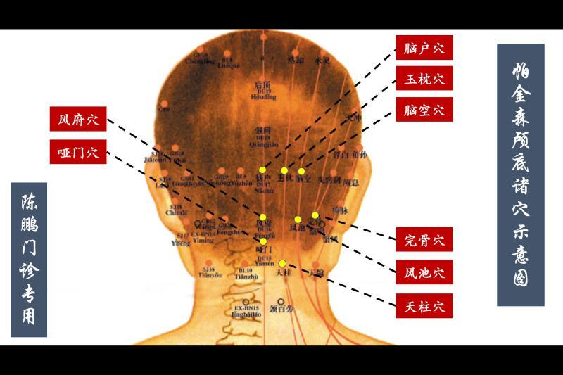 帕金森病的家庭穴位按摩