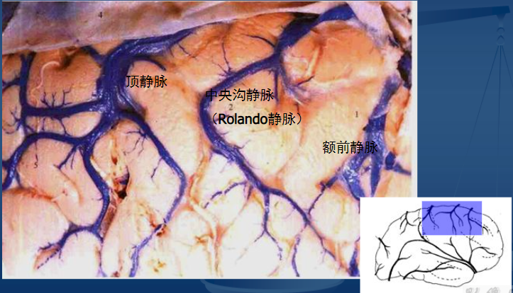 大脑上静脉的组成