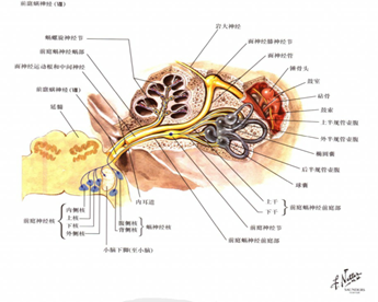 听神经瘤解剖位置图片