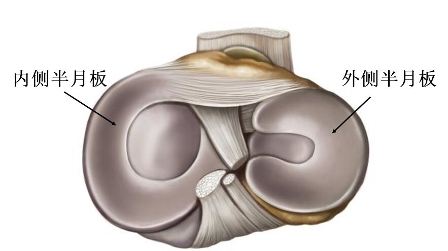 半月裂孔图片
