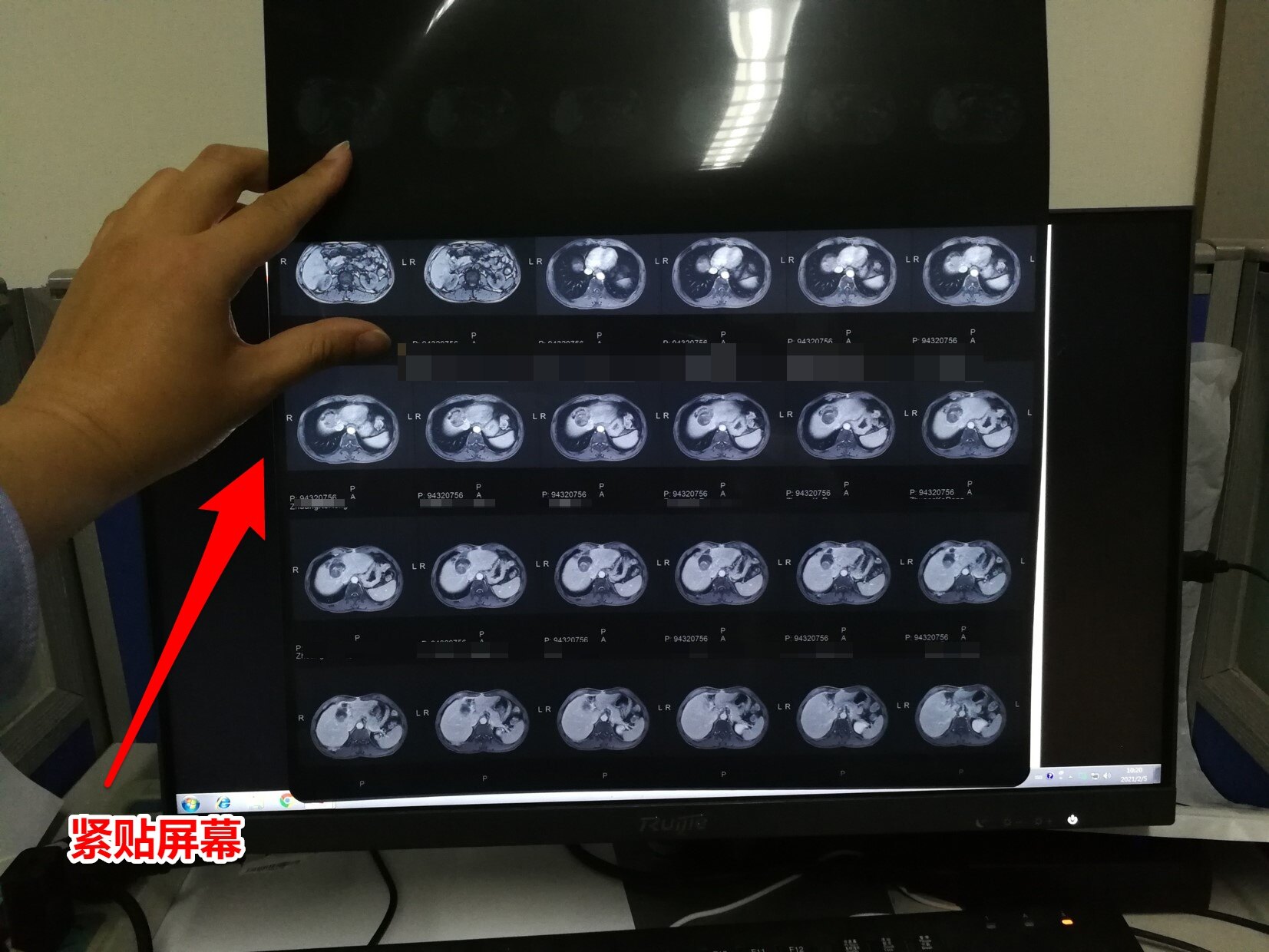 如何拍出適合網絡就診或者會診的ct,mri照片? - 好大夫在線