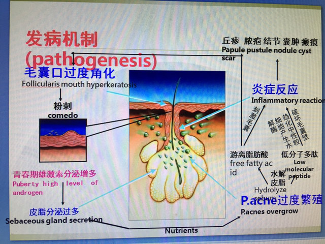 痤疮健康教育处方