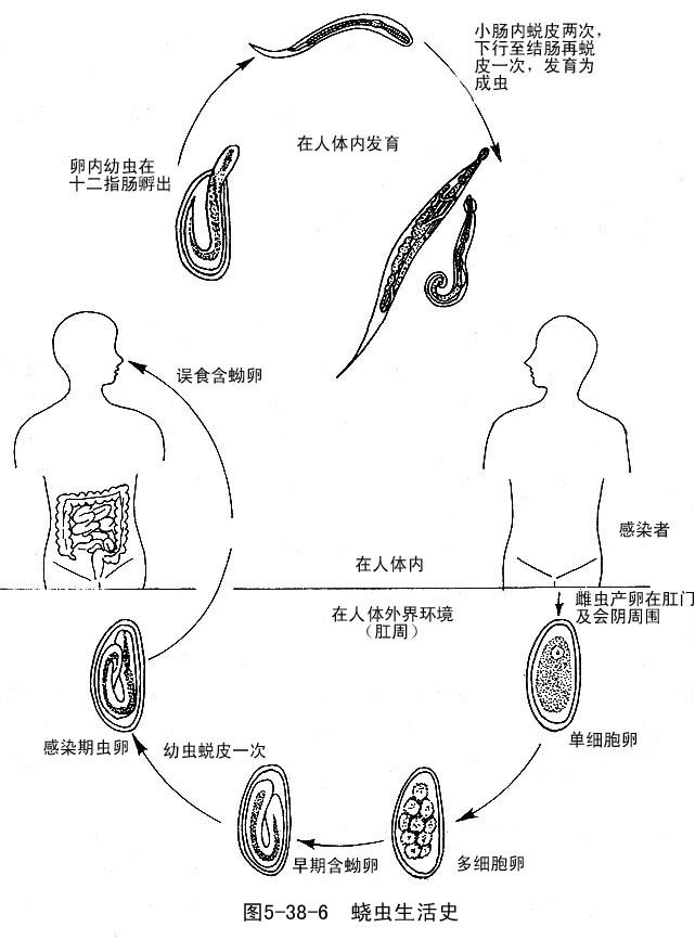 肛门蛲虫病的症状图片
