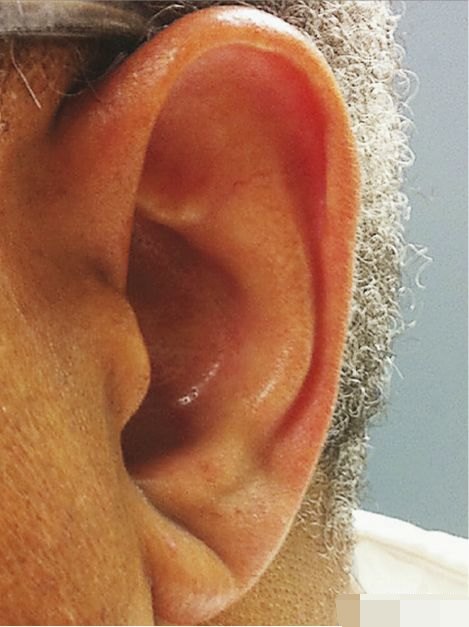 【耳的功能】耳朵只能听声音吗?