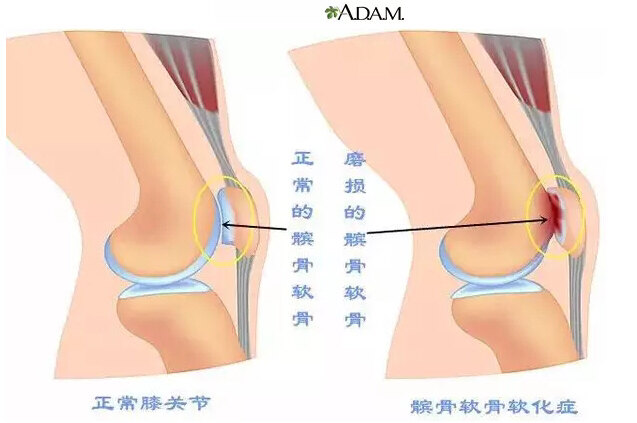 暂无