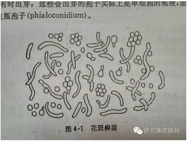皮肤美丽简单说之88:引起汗斑的马拉色菌 - 好大夫在线