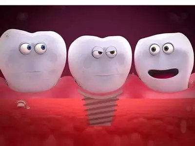 种植牙可以用一辈子吗