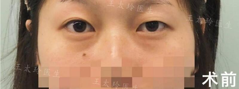 圖文圖片