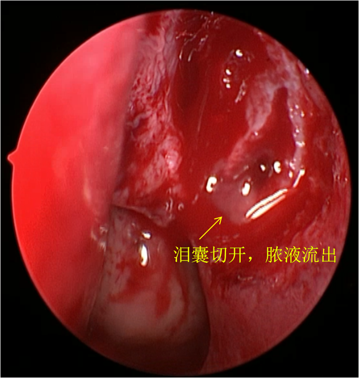 暂无