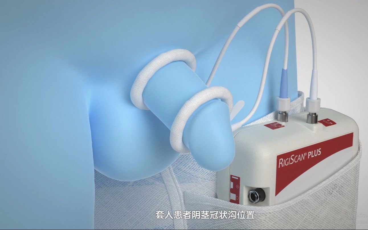 您值得一试的诊断「勃起功能障碍/阳痿」的检查:视听性刺激勃起检测