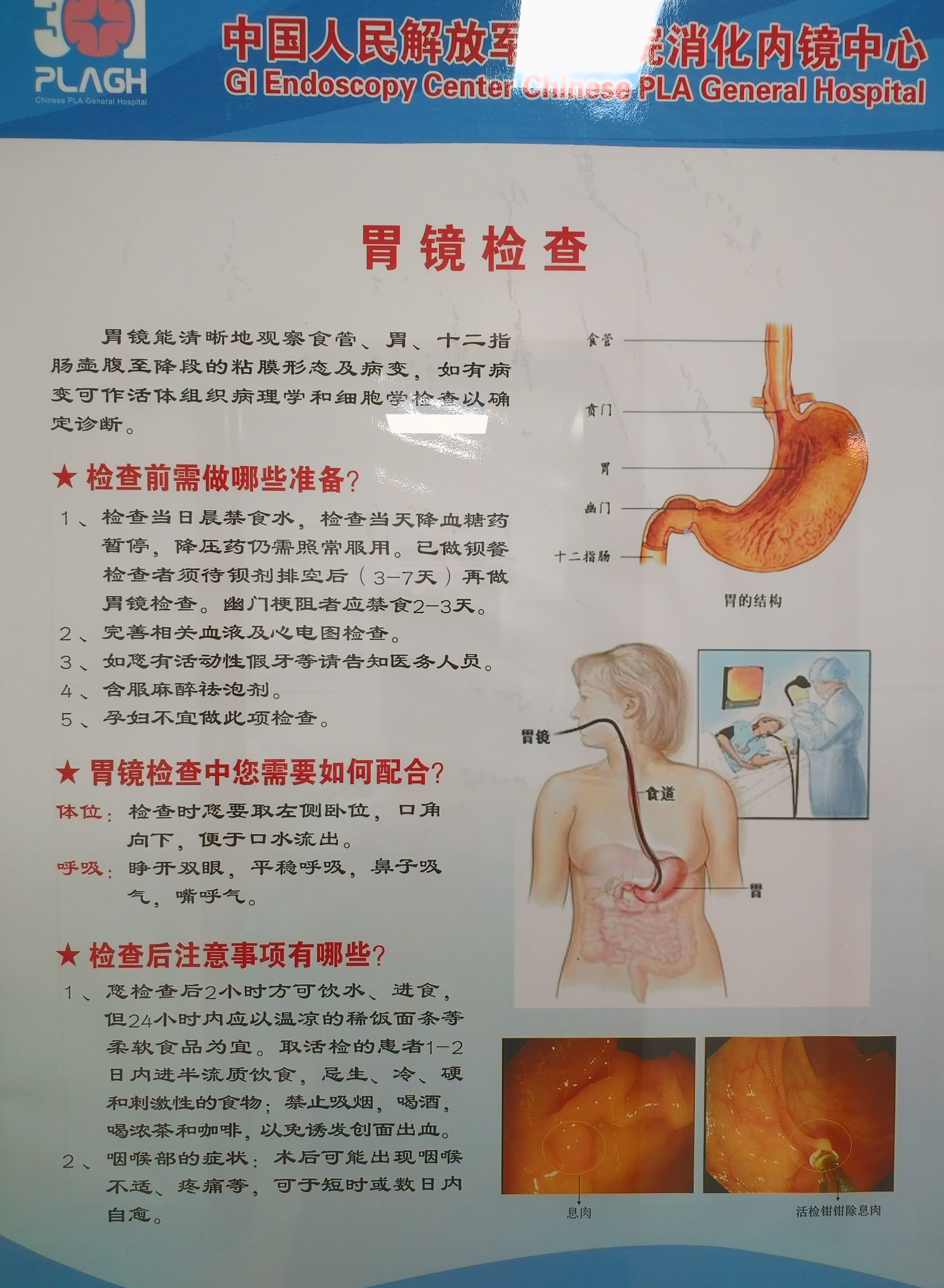 胃镜检查1.jpg