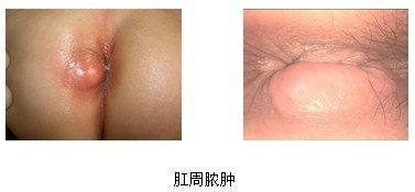 暂无