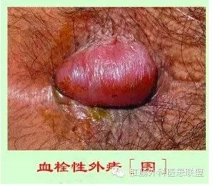 暂无