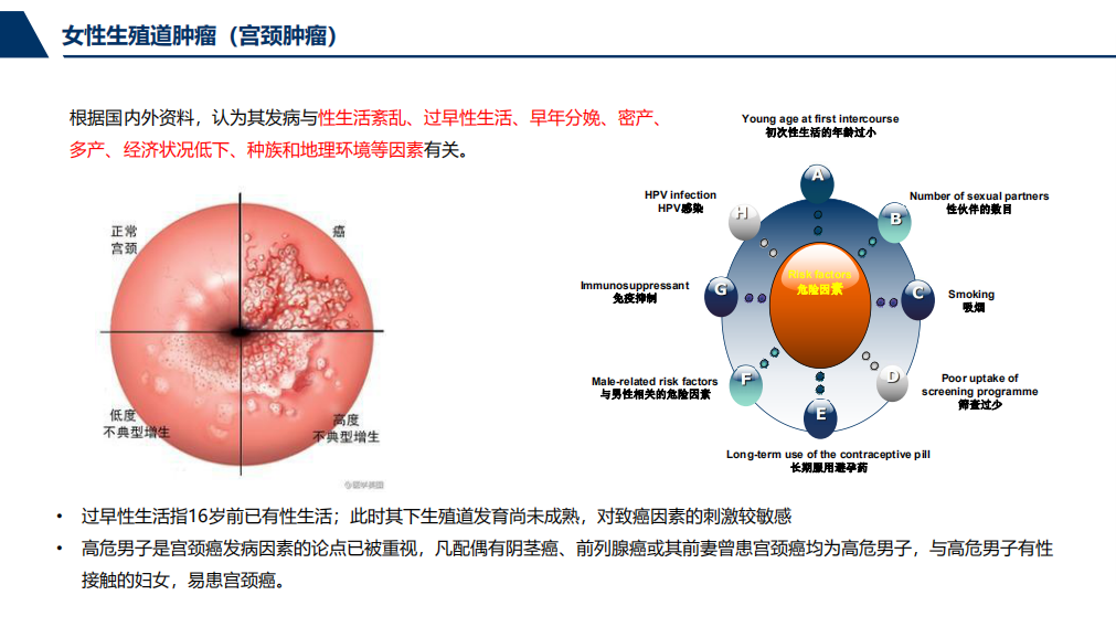 女性盆腔肿瘤简介与早期防治(含视频宣教)_妇科肿瘤_疾病介绍_相关