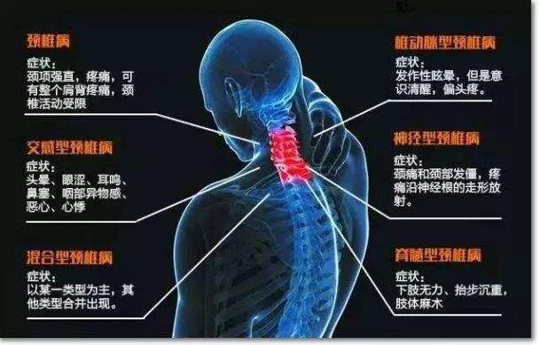 怎么才能做非牛顿体 uoYBAFw57pOATL5nAACTPnSyl0g598.jpg?_ms_=2ed0