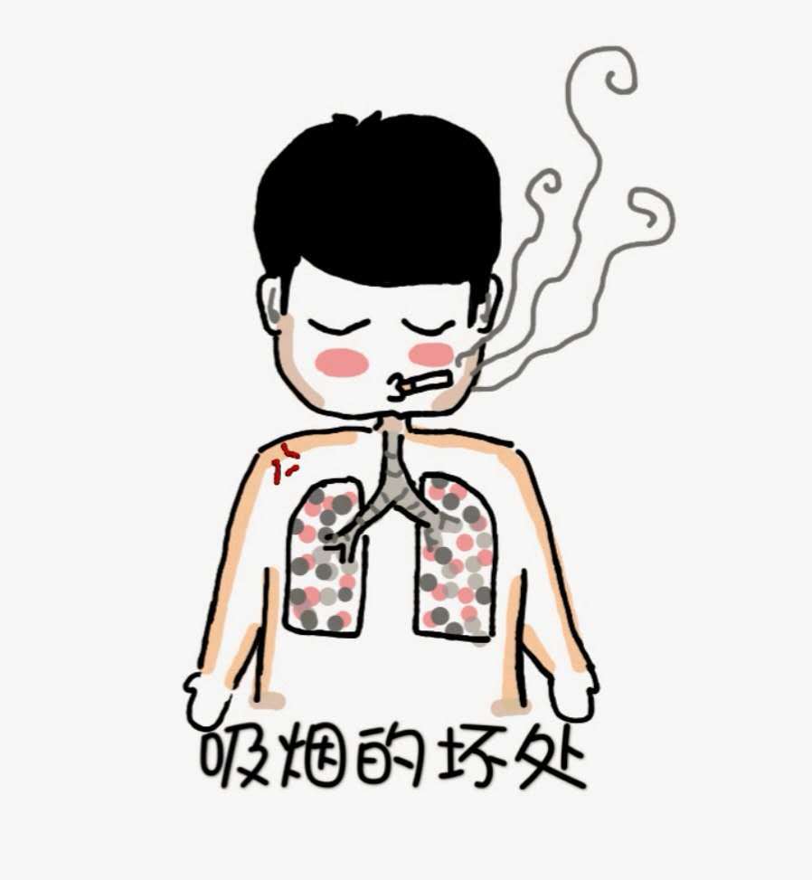 肩痛科普知识系列问答(70)肩关节镜手术要戒烟吗? - 好大夫在线