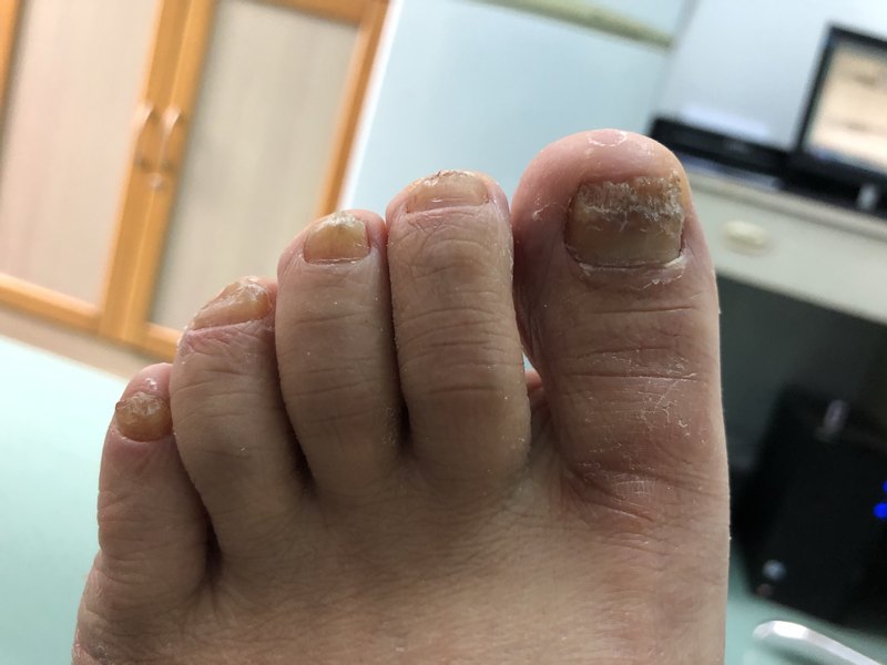 圖文圖片