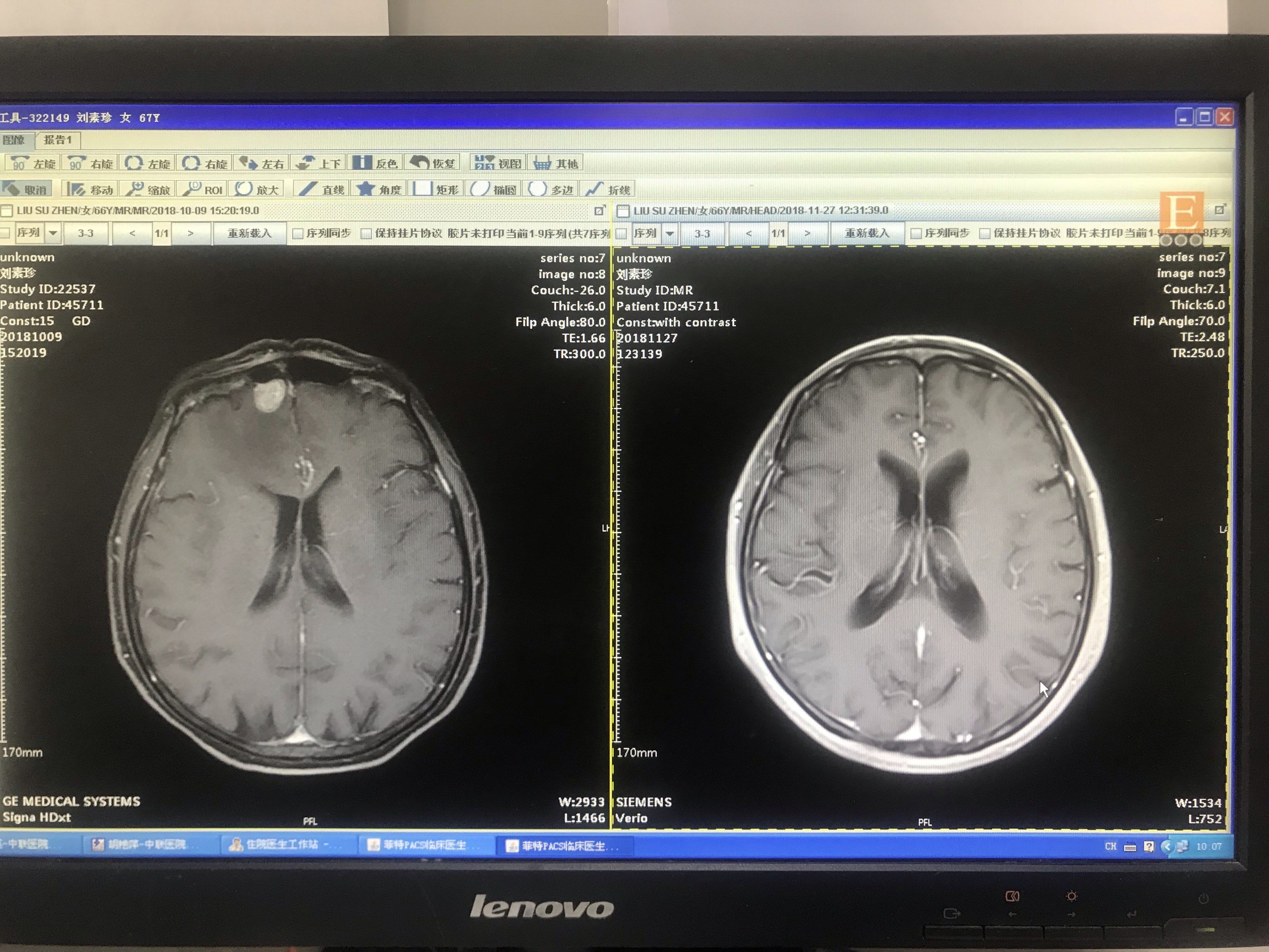 肿瘤晚期患者起死回生源于信任 - 好大夫在线