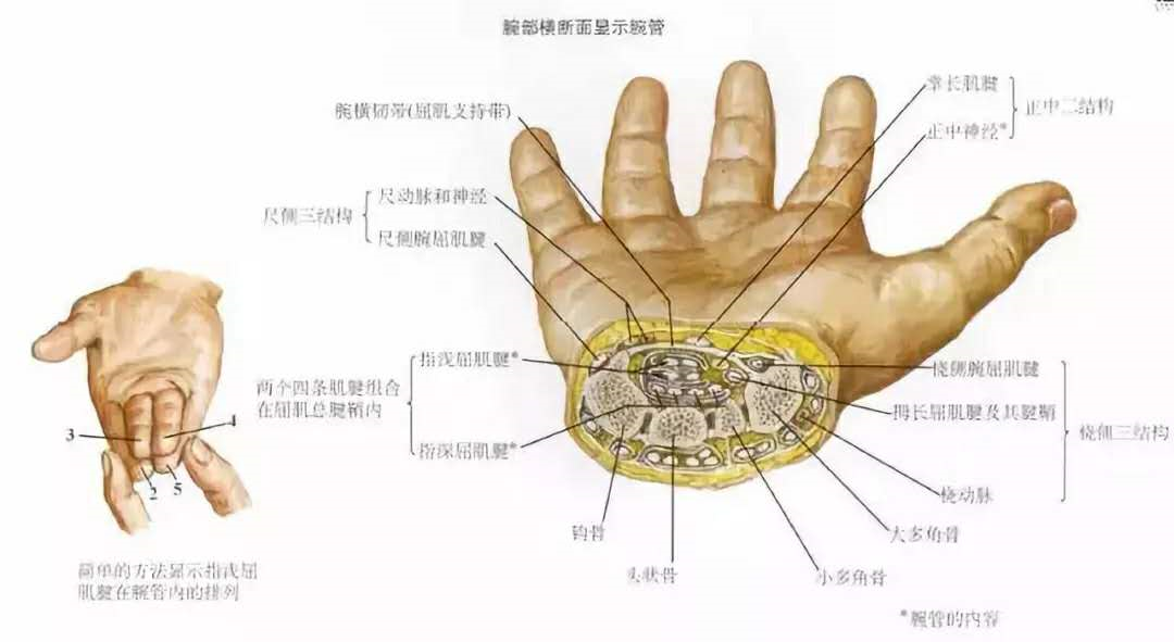 腕管综合症解剖图图片