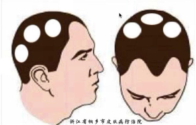視頻封面