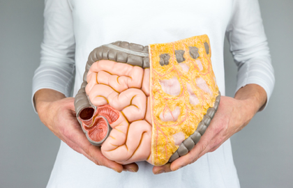 胃腺体肠化是什么?