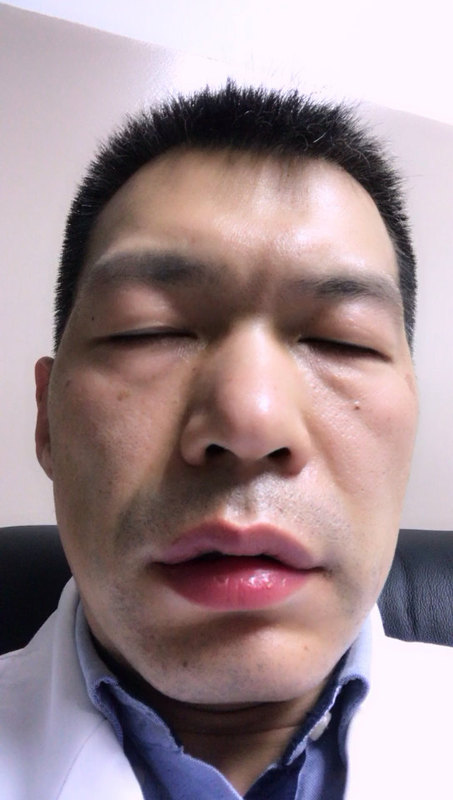 視頻封面