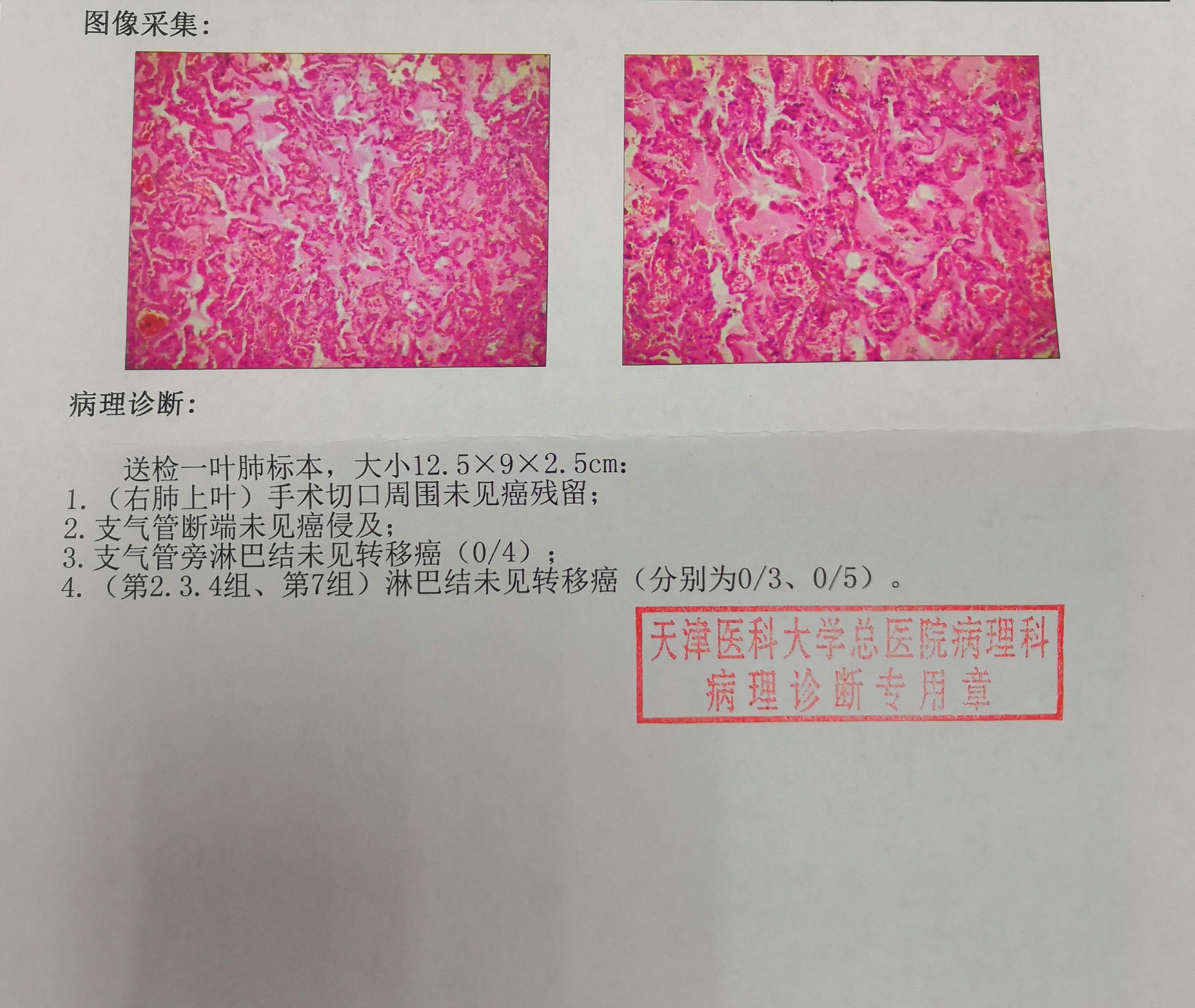 手术后病理报告第一部分