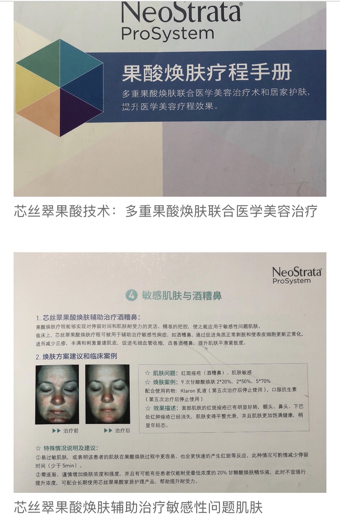 暂无