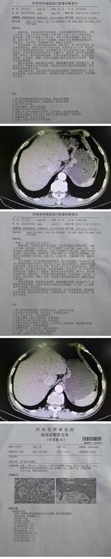 圖文圖片