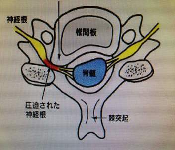 示意图.jpg