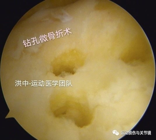 暂无